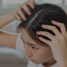 髪・頭皮のお悩み