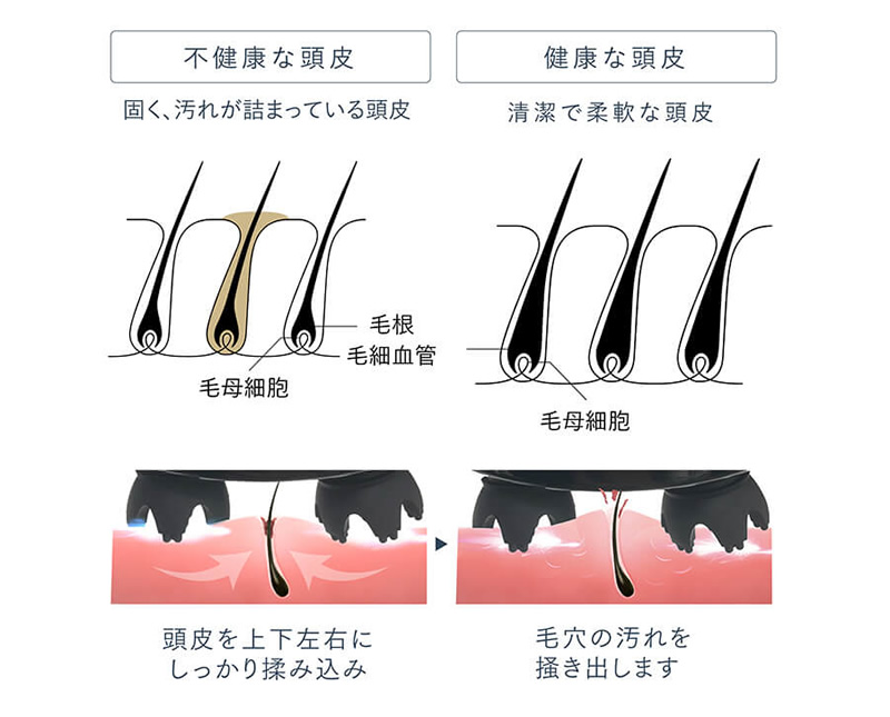 EMSヘッドスパ使用