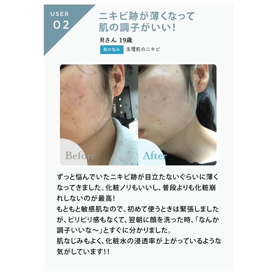 正規販売店】redeal. リディアル RDセラム 30ml 美容液 アクネ