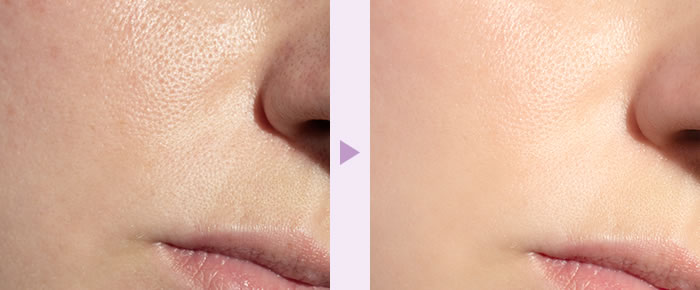 正規販売店 t:aim ティエイム ExoRN Ampoule