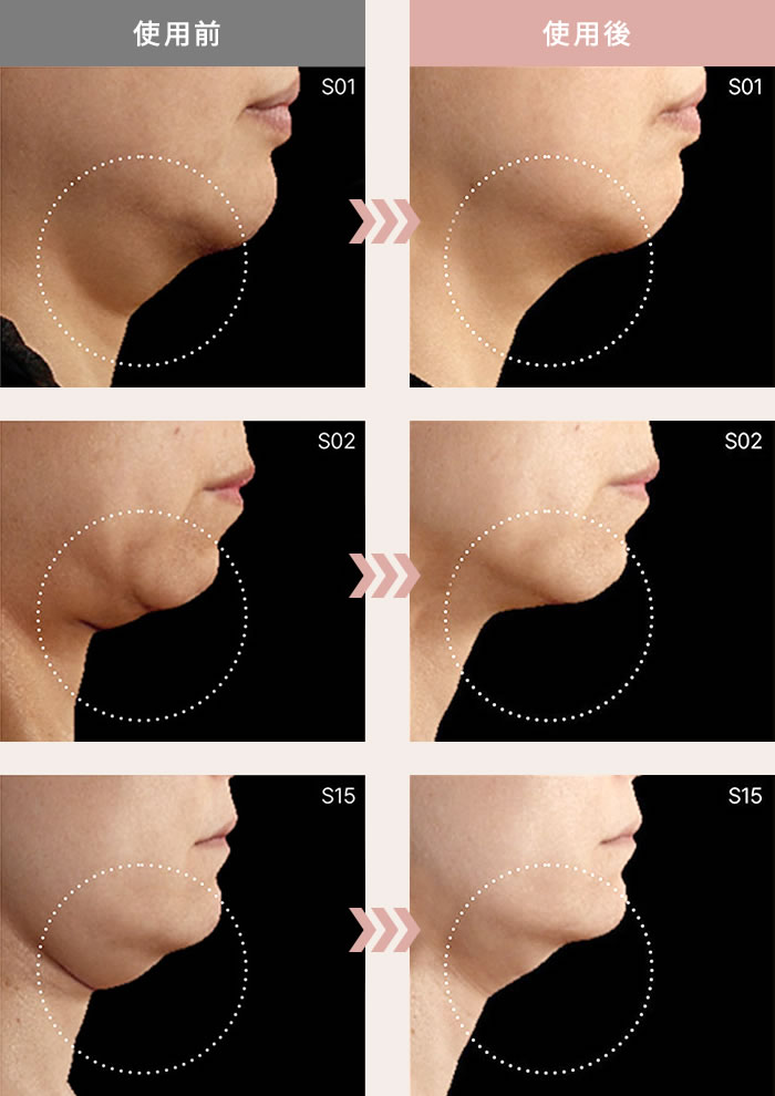 正規販売店 ティエイム V バンド 見た目の変化 ティエイム